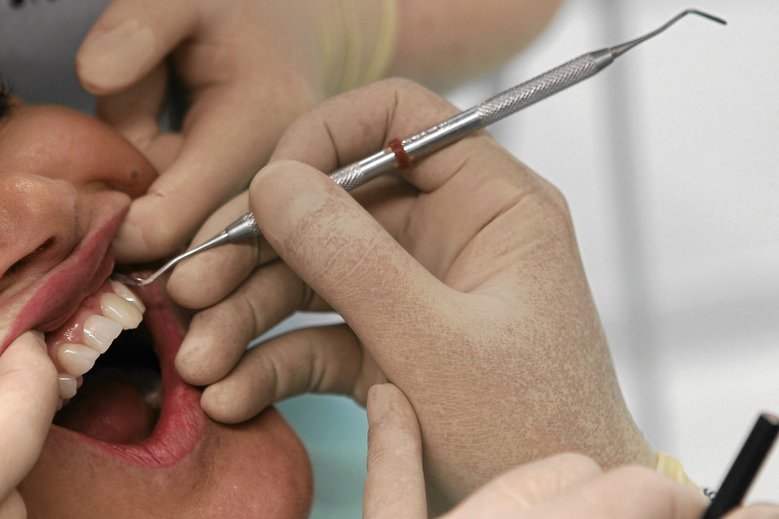 Antykanałowcy chcą nas przestraszyć, że leczenie kanałowe zębów może nam zaszkodzić. Nie wierzcie w to.