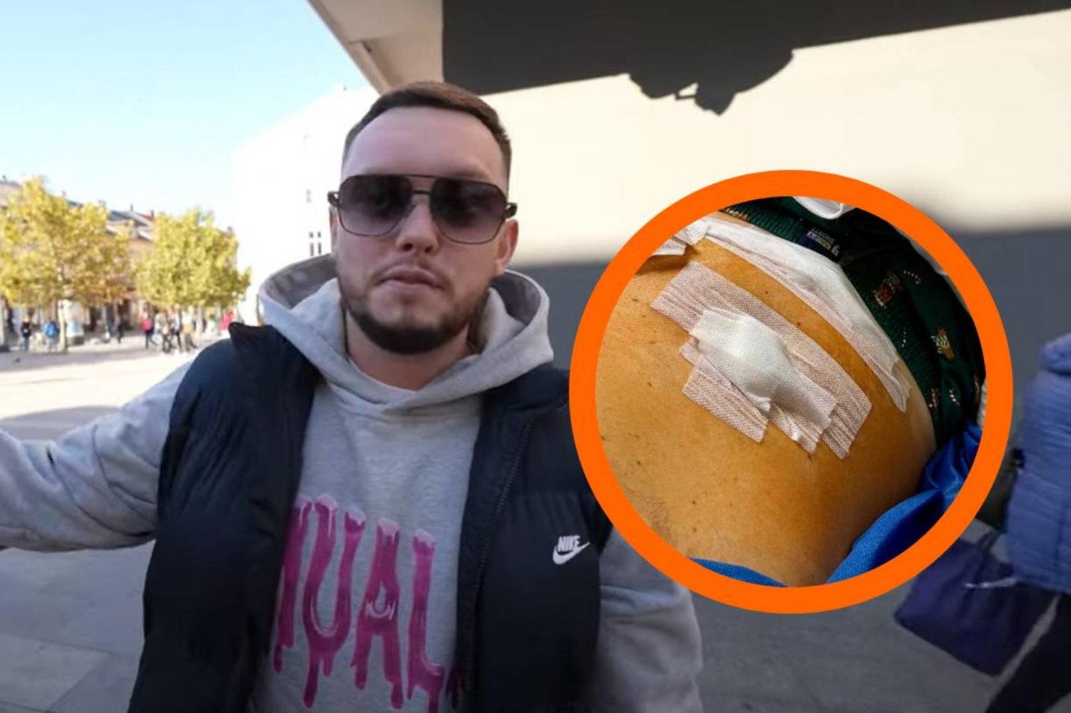 Popularny youtuber Książulo przeszedł pilną operację. Pokazał zdjęcie.