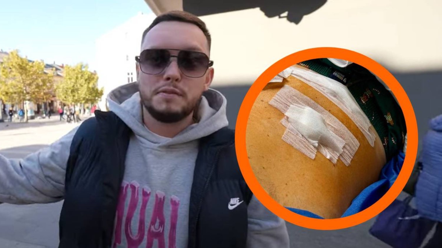 Popularny youtuber Książulo przeszedł pilną operację. Pokazał zdjęcie.
