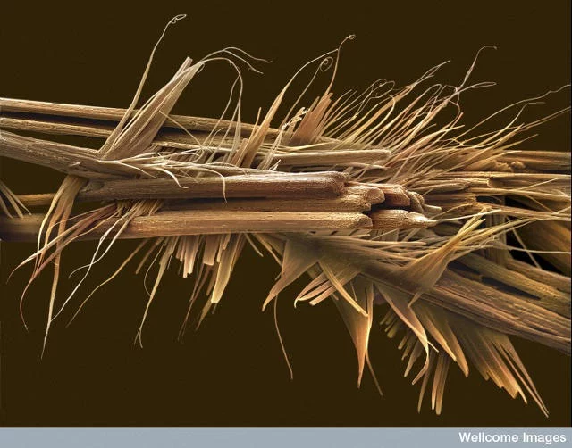 Fot. Flickr/[url=http://bit.ly/1GTsQoB/]Wellcome Images/ [url=http://bit.ly/1HAGi4E BY-ND[/url]