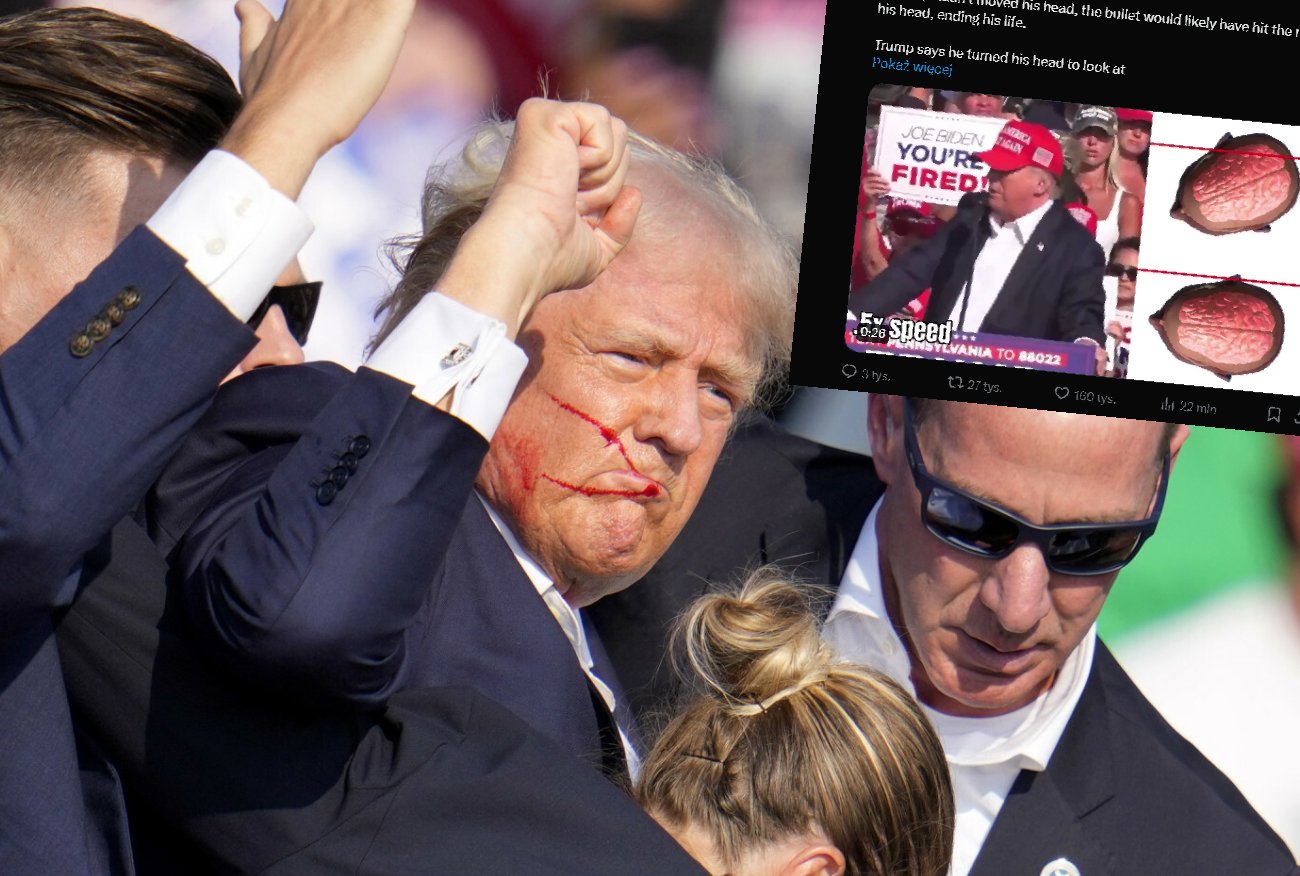 Dlatego Donald Trump przeżył zamach. Uratowało go przechylenie głowy.