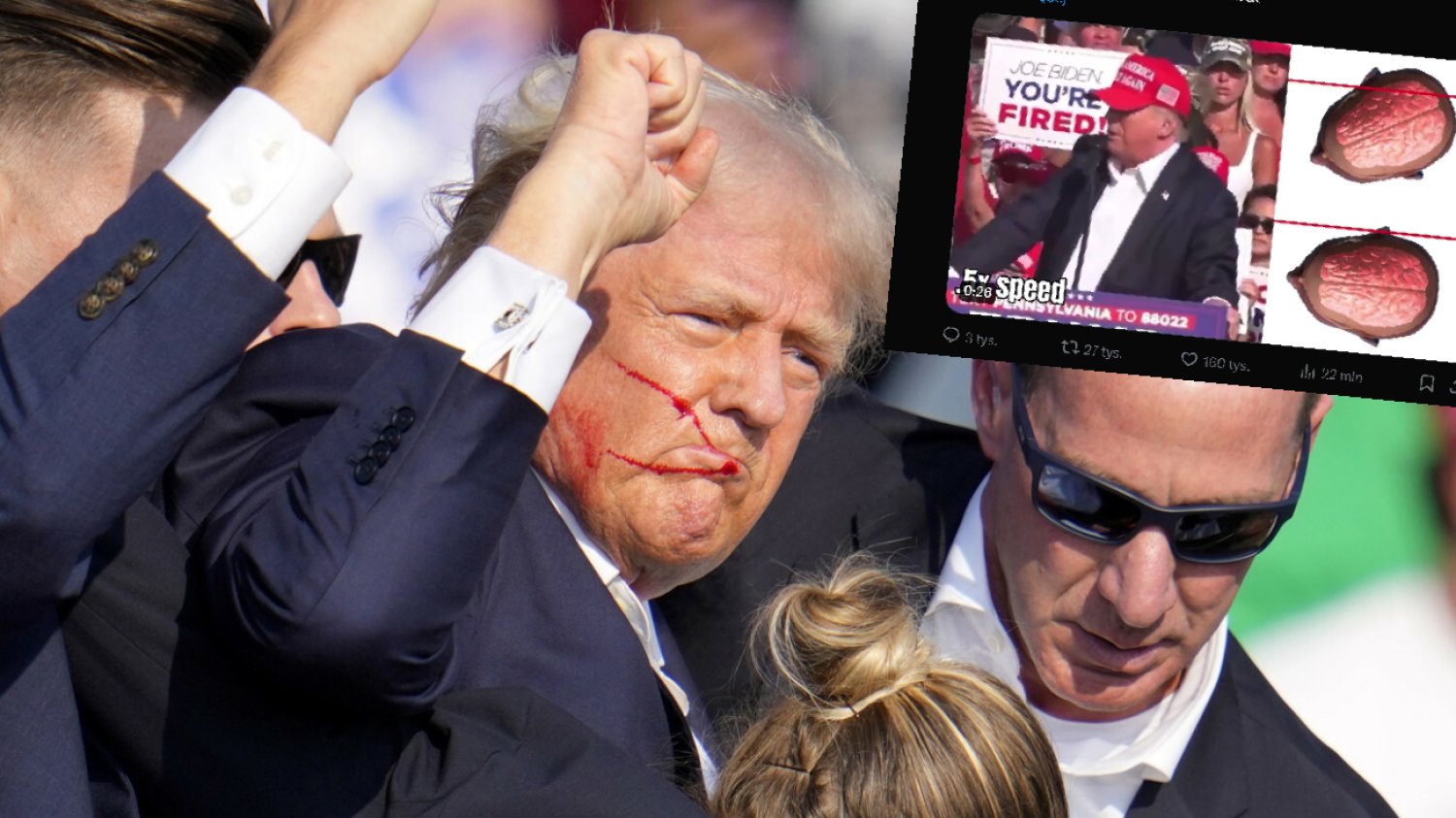 Dlatego Donald Trump przeżył zamach. Uratowało go przechylenie głowy.