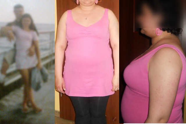 Zdjęcie Eweliny przed (z lewej) i po chorobie.