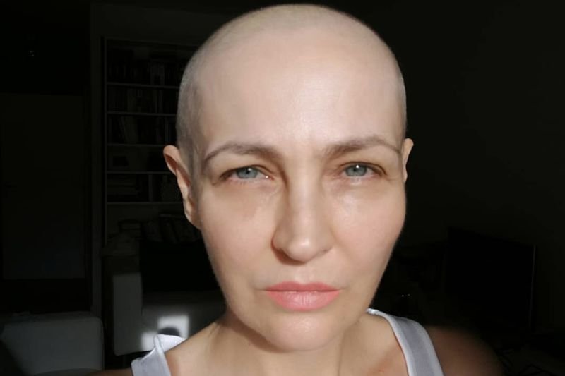 Anna Puślecka o refundacji leku rybocyklib.