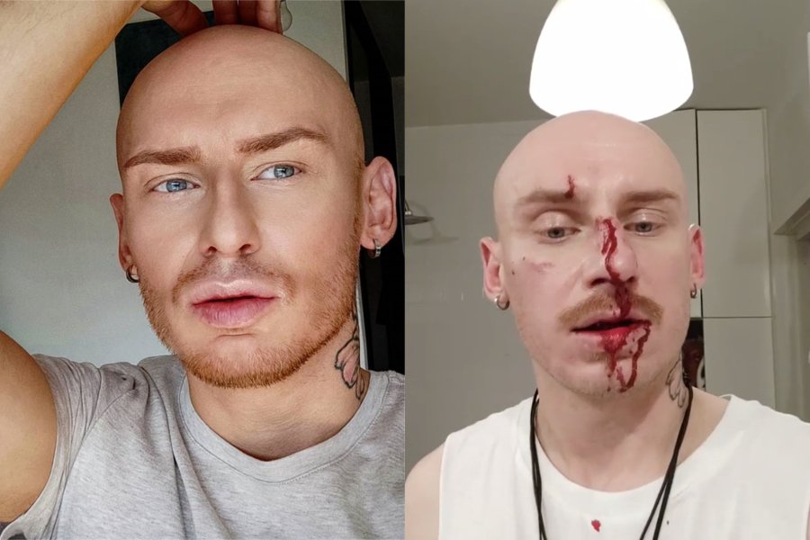 Znany stylista został pobity na ulicy