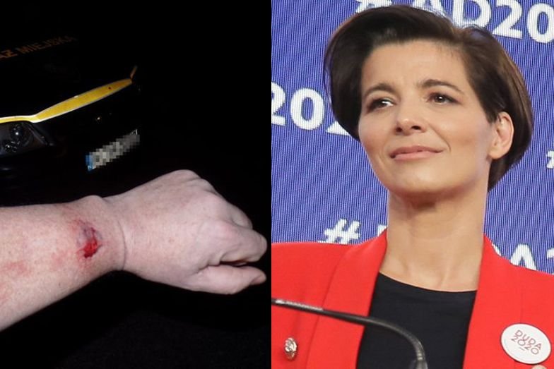 Szefowa sztabu Andrzeja Dudy ugryzła mieszkańca Milanówka.
