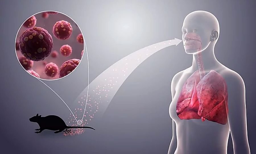 Co to jest tulawirus i choroba hantawirusowa? Nowe dane o zakażonym Niemcu