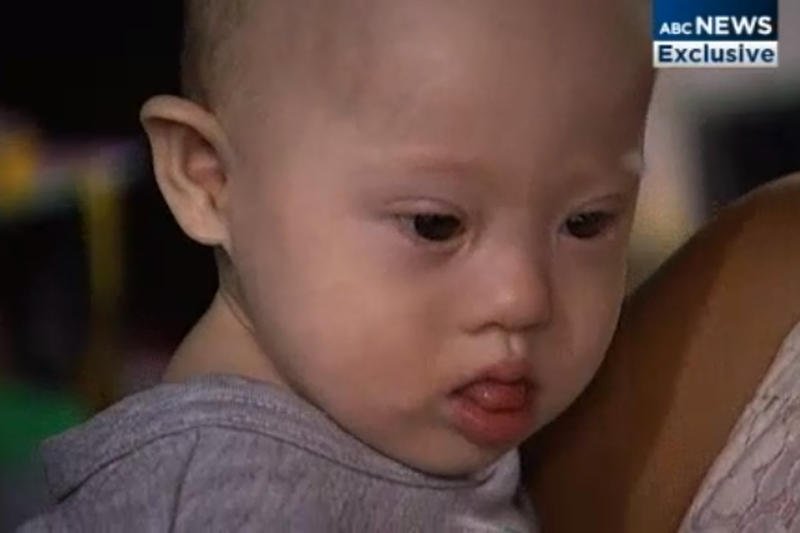 Surogatka urodziła dziecko z zespołem Downa, więc rodzice postanowili go nie zabierać