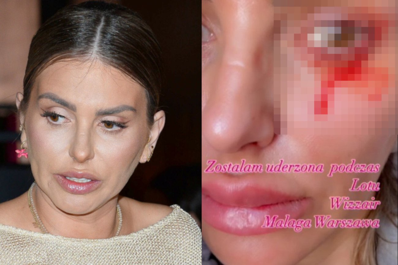 Monika Goździalska twierdzi, że została uderzona w samolocie