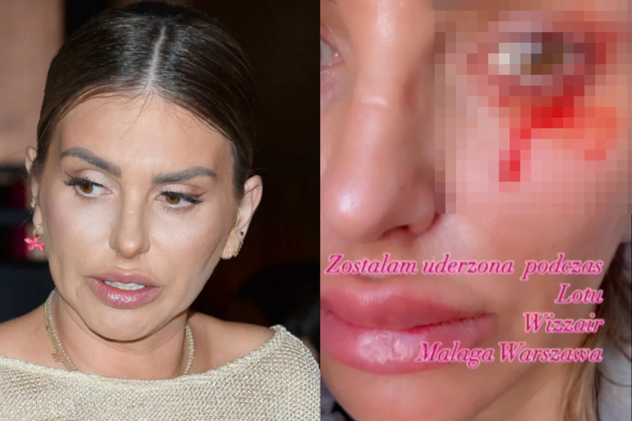 Monika Goździalska twierdzi, że została uderzona w samolocie