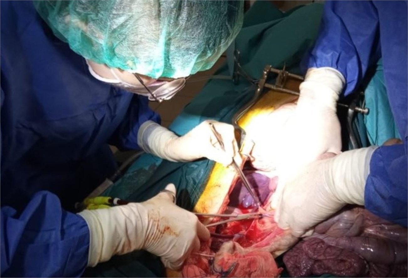 Wynalazek polskiej spółki może zrewolucjonizować w przyszłości transplantologię.