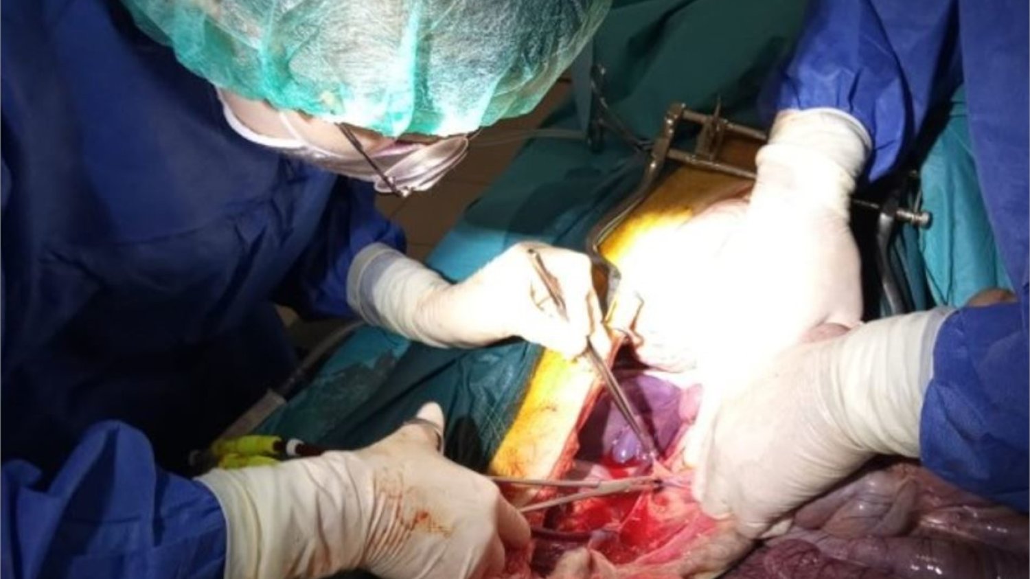 Wynalazek polskiej spółki może zrewolucjonizować w przyszłości transplantologię.