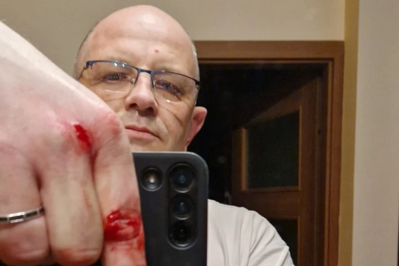 Tomasz Pitucha uciekał przed dzikiem w Lublinie.