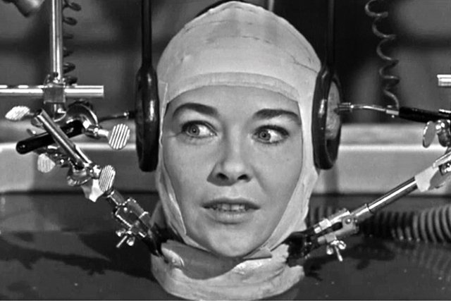 Pierwsza transplantacja głowy raczej nie za dwa lata...