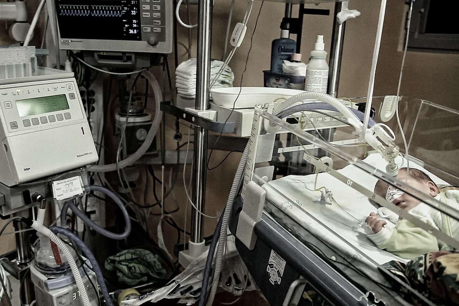 Jeden z małych pacjentów cierpiących na klątwę Ondyny