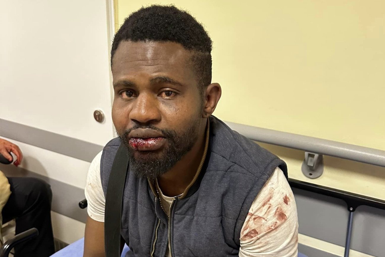 Dostawca pizzy z Lublina brutalnie pobity. Pizzeria apeluje