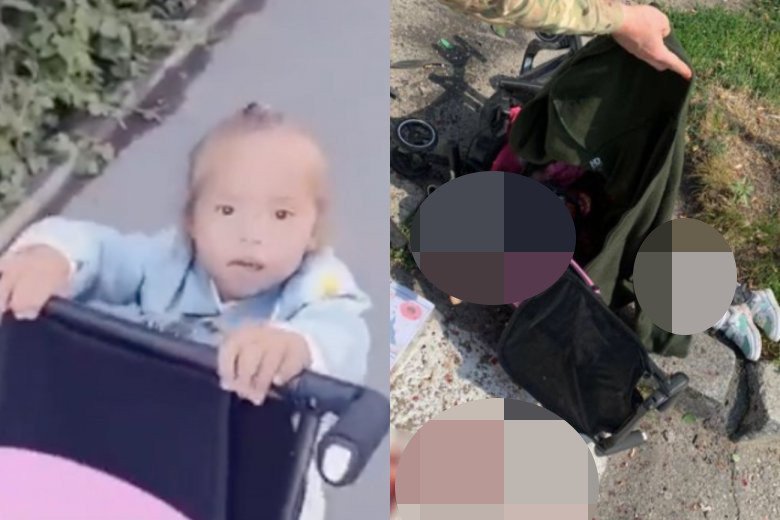 Czteroletnia Liza. Po lewej dziewczynka dwie godziny przed śmiercią.