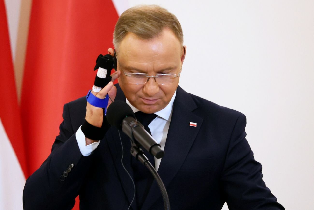 Co się stało Andrzejowi Dudzie? Tak wygląda jego dłoń bez opatrunku