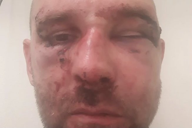 Przemysław Witkowski rozpoznał sprawcę swojego pobicia.