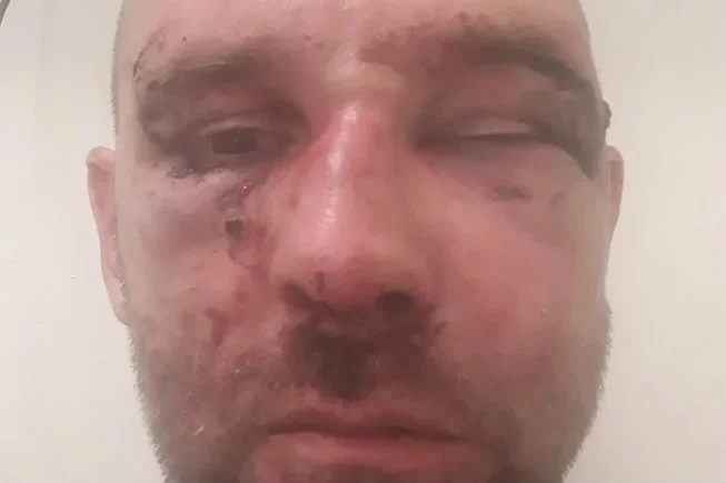 Przemysław Witkowski rozpoznał sprawcę swojego pobicia.