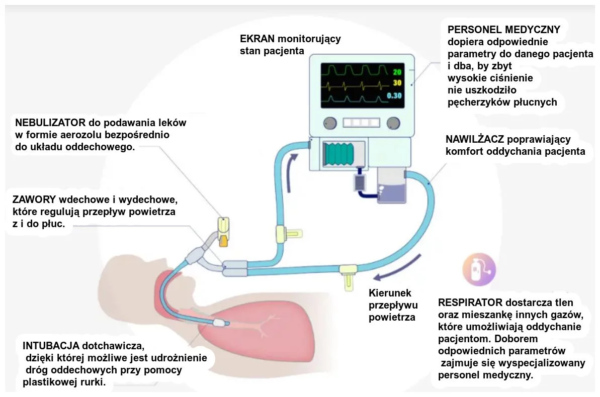 Jak działa respirator (sztuczne płuca)? Cena, budowa, działanie [VIDEO]