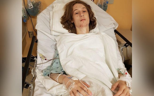 Operacje Dominika polegają na wycięciu bliznowców do głębokości kości lub mięśni na całym oparzeniu. Koszmarny wypadek zamienił życie chłopca w pasmo cierpienia