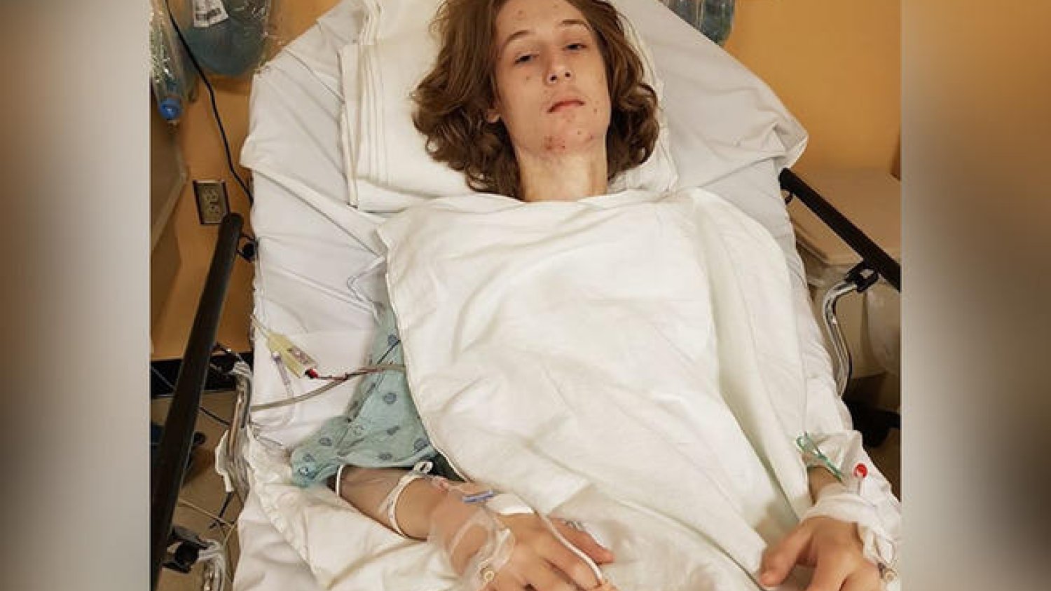 Operacje Dominika polegają na wycięciu bliznowców do głębokości kości lub mięśni na całym oparzeniu. Koszmarny wypadek zamienił życie chłopca w pasmo cierpienia