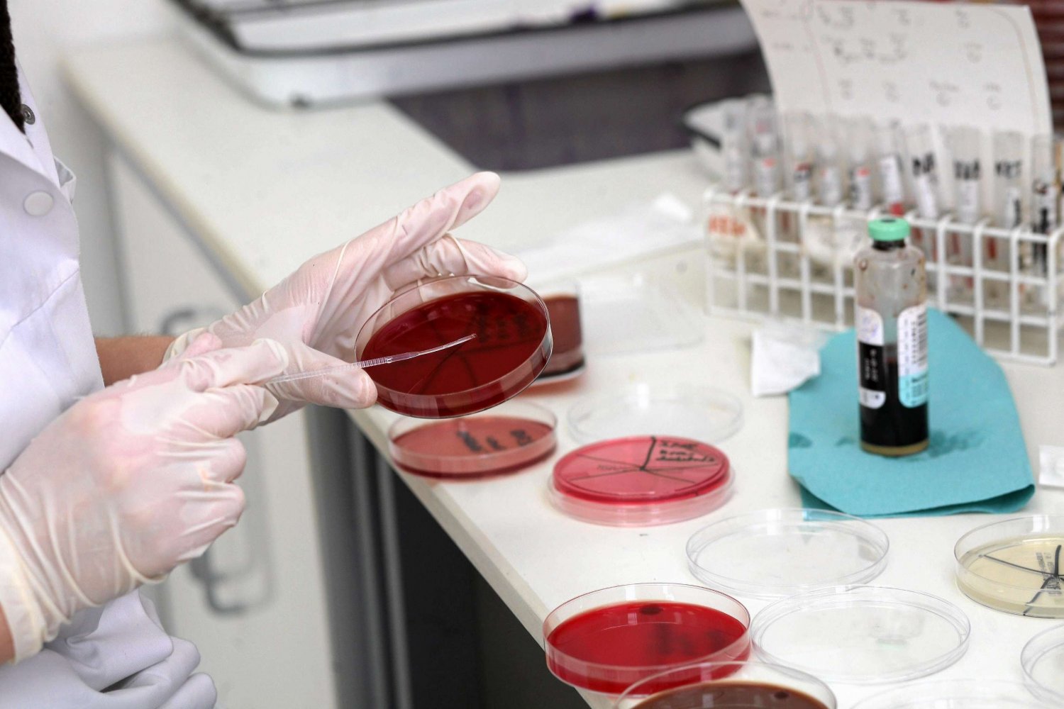 Naukowiec przeprowadza badanie komórek na oddziale mikrobiologii. Białostocki Uniwersytet Medyczny.