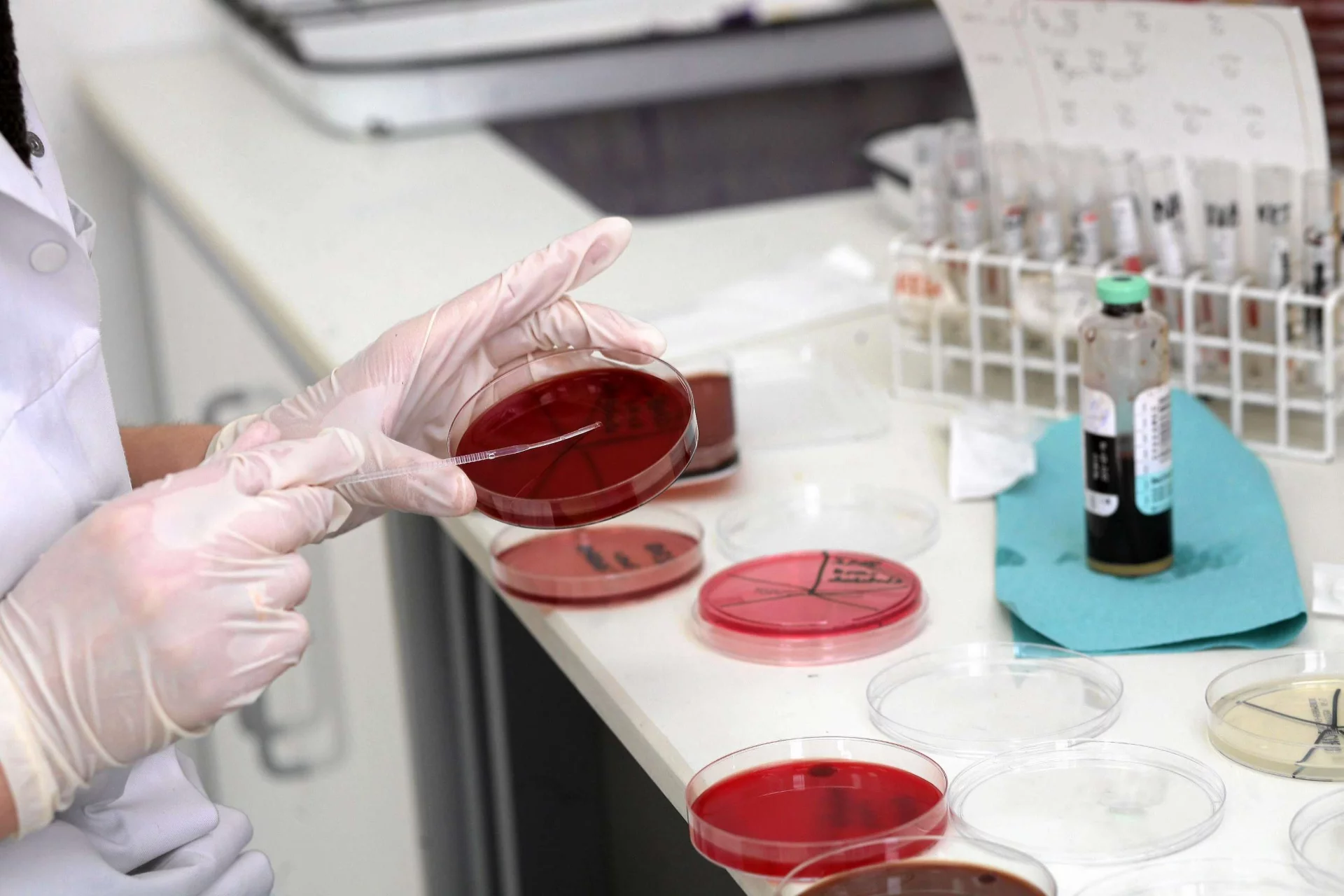 Naukowiec przeprowadza badanie komórek na oddziale mikrobiologii. Białostocki Uniwersytet Medyczny.