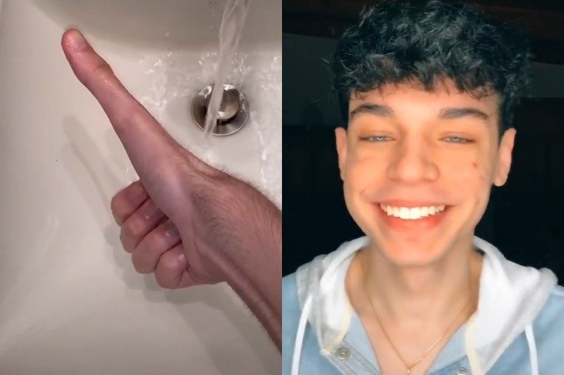 Jacob Pina potrafi na zawołanie wydłużyć swój kciuk.