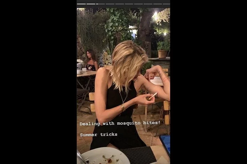Anja Rubik przypalała miejsce po ukąszeniu komara papierosem.