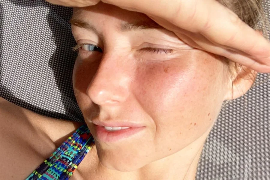 Agata Rubik opowiedziała o swoich problemach z trądzikiem