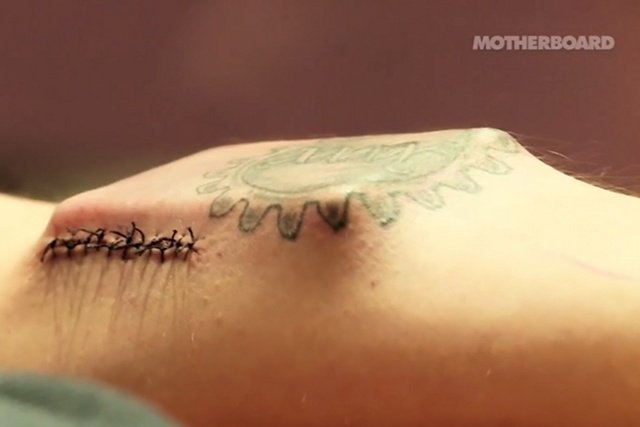 Przekaźnik Circadia 1.0 został zaszyty w przedramieniu Tima Cannona