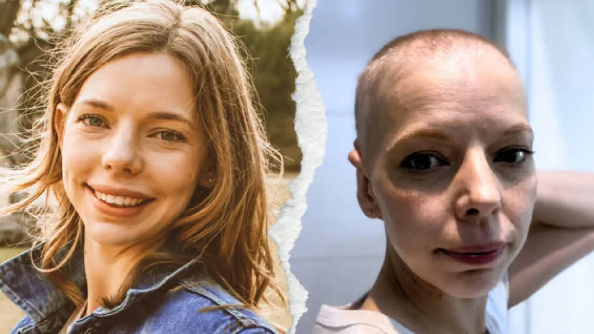 Kornelia walczy z agresywnym chłoniakiem. Na zebranie środków zostało kilka czasu