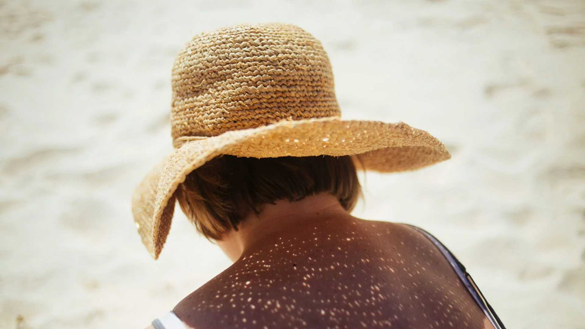 Upał nie jest groźny. Dermatolodzy mówią, kiedy UV niszczy skórę najbardziej