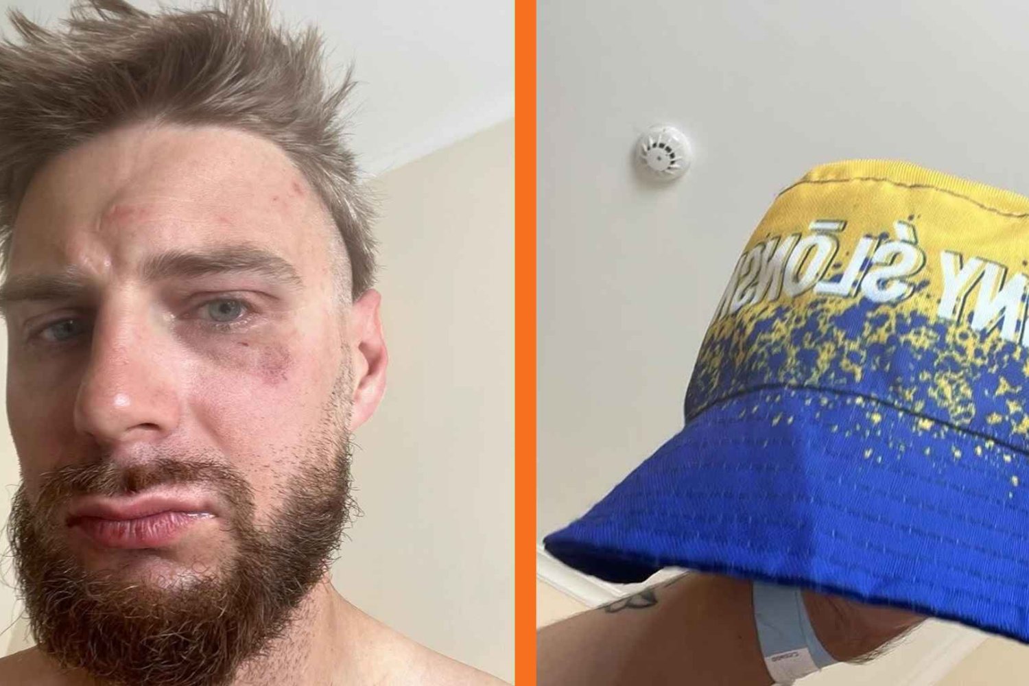 po lewej: Kuba Heisig, po prawej: czapka w barwach śląska
